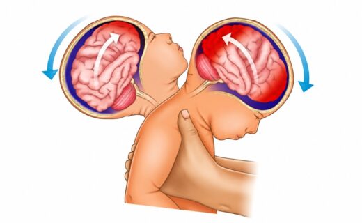 La Maternidad Sardá prepara un programa para prevenir el síndrome del bebé sacudido y acompañar a las familias frente al llanto, el cansancio y el estrés.